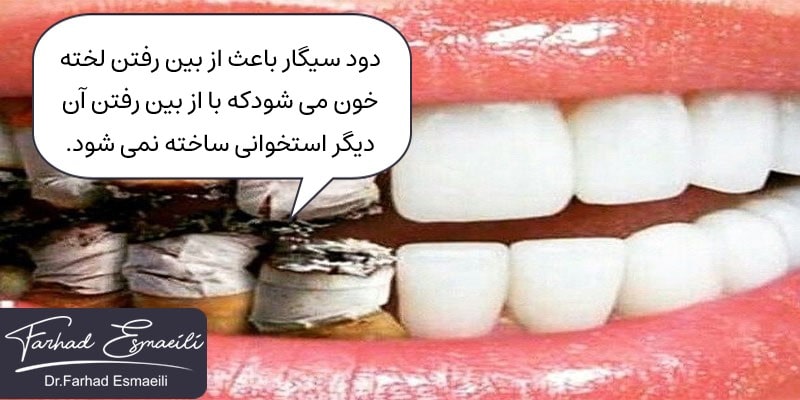لخته های خون با دود سیگار از بین می روند