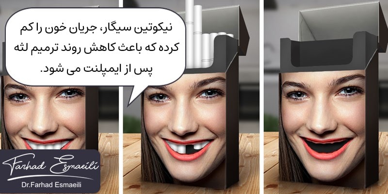 نیکوتین سیگار، باعث کاهش فرآیند ترمیم لثه می شود