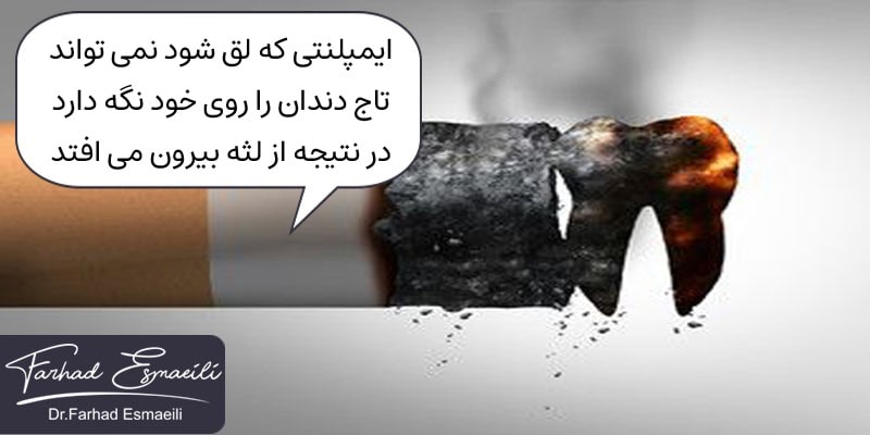 لق شدن ایمپلنت دندان بخاطر سیگار کشیدن