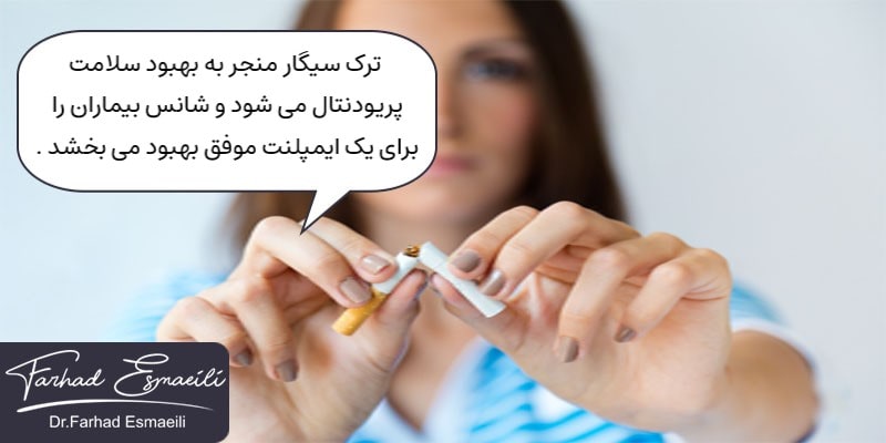 سیگار کشیدن پس از کاشت ایمپلنت