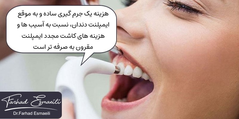 جرم گیری به موقع ایمپلنت دندان مانع از هزینه های اضافه بعدی می شود.