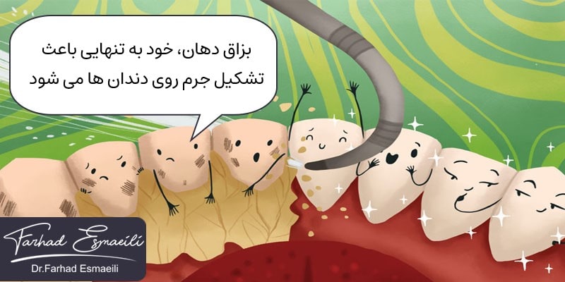 تشکیل جرم ایمپلنت دندان با بزاق دهان