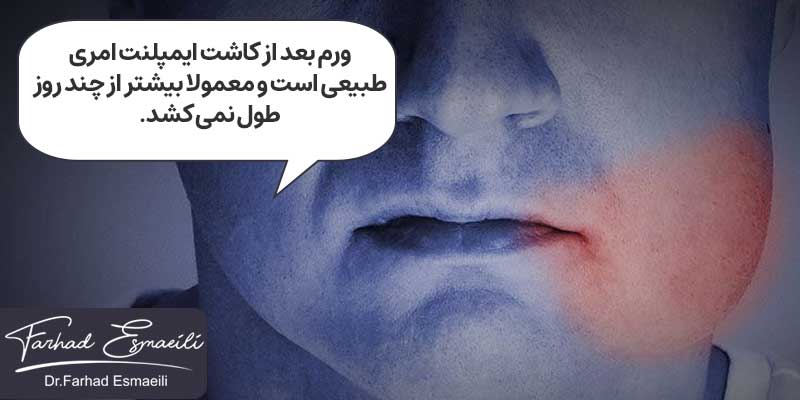 ورم بعد از ایمپلنت دندان، امری طبیعی