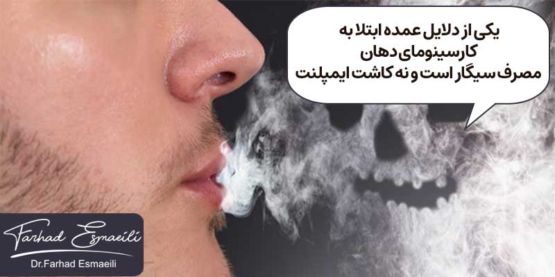 سیگار یکی از دلایل عمده ابتلا به کارسینومای دهانی