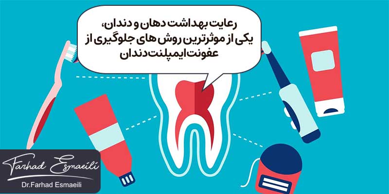 رعایت بهداشت دهان و دندان یکی از موثرترین روش های جلوگیری از عفونت ایمپلنت دندان