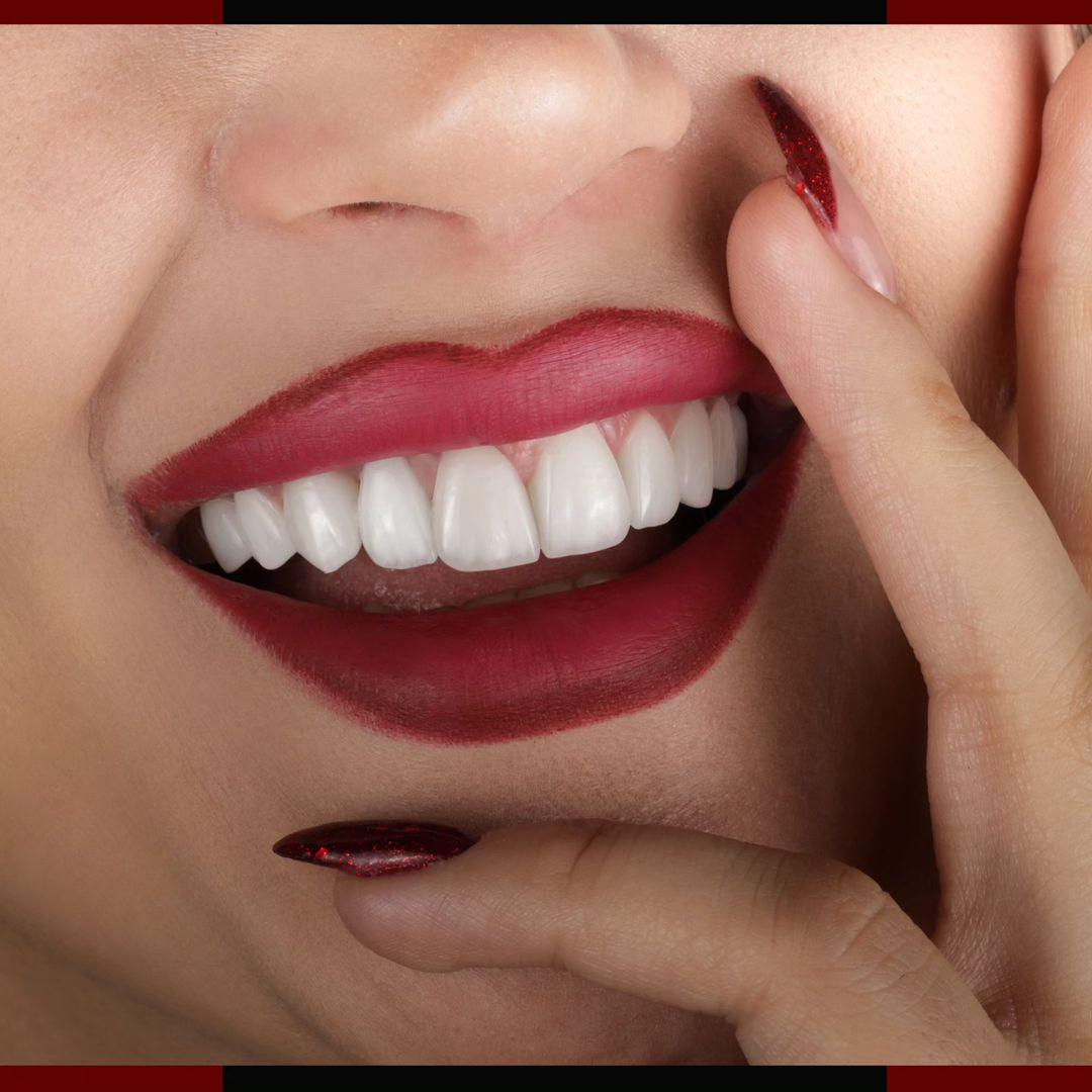 لمینیت سرامیکی و اصلاح طرح لبخند در اصفهان