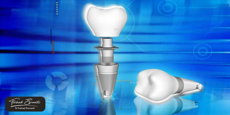 معایب دندانپزشکی دیجیتال چیست؟