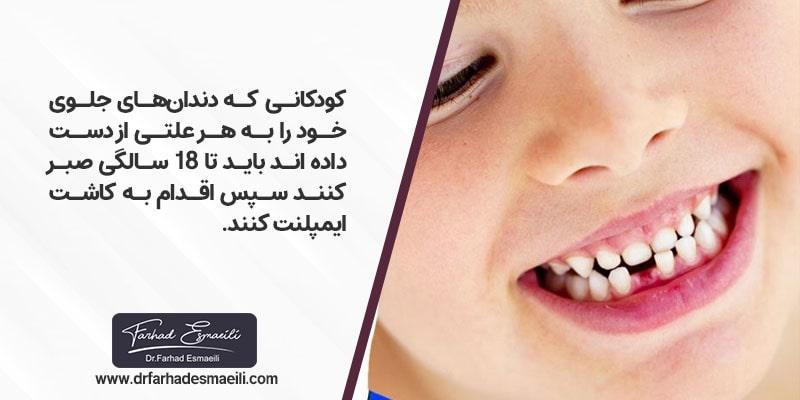 کودکانی که دندان‌های جلوی خود را به هر علتی از دست داده اند باید تا سن ۱۸ سالگی صبر کنند سپس برای کاشت ایمپلنت دندان اقدام نمایند 