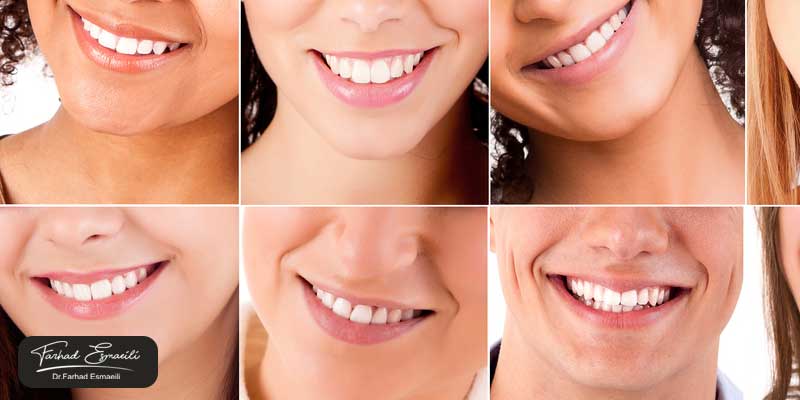 بهترین متخصص دندانپزشکی زیبایی در اصفهان چه ویژگی‌هایی باید داشته باشد؟