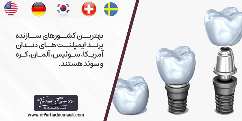 بهترین کشورهای سازنده ایمپلنت در جهان