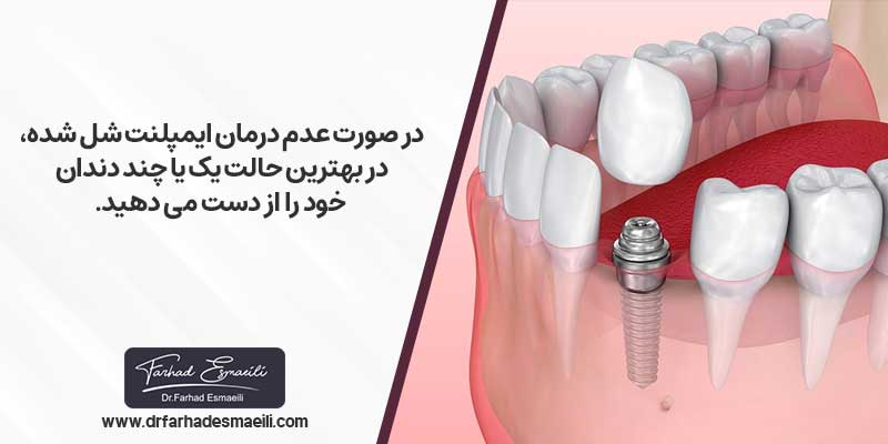 عوارض لق شدن روکش ایمپلنت دندان