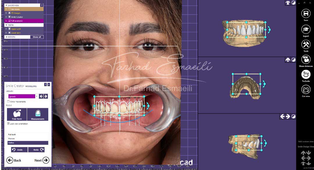 نمونه اصلاح طرح لبخند دیجیتال
