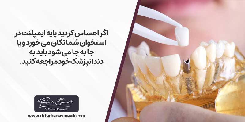 تشخیص شل شدن ایمپلنت دندان
