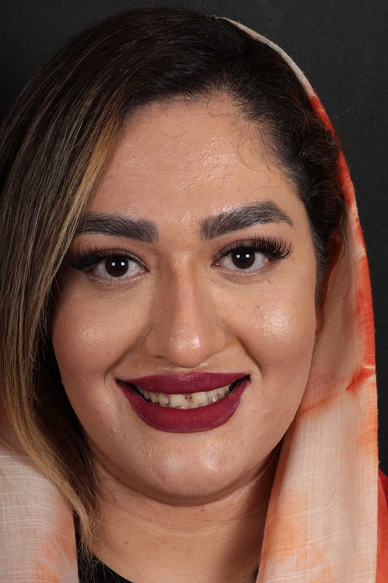 نمونه دندانپزشک زیبایی دیجیتال 