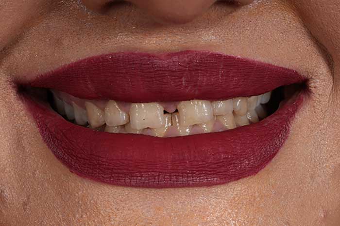 بررسی کیس زیبایی به روش دیجیتال توسط دکتر فرهاد اسماعیلی