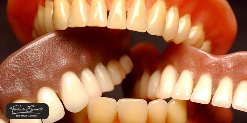 دندان مصنوعی یا پروتز های متحرک