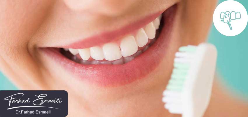 مراقبت های بعد از لمینت دندان