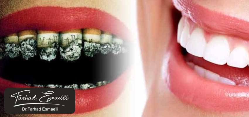 کاهش بهداشت دهان و دندان