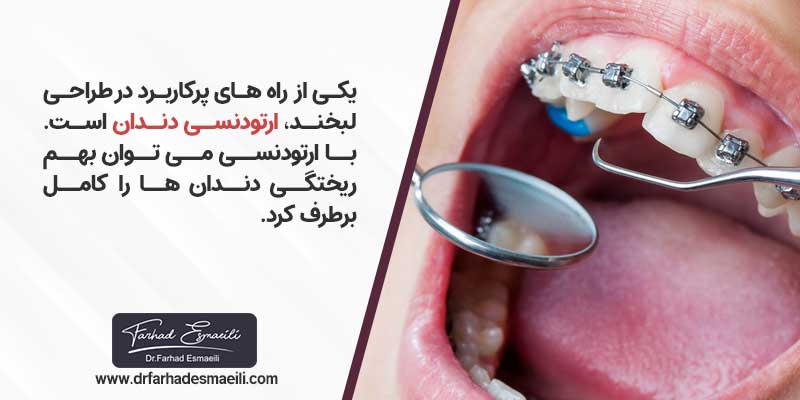 اصلاح طرح لبخند با ارتودنسی