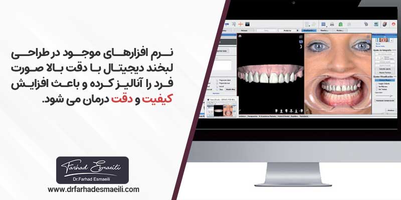 طراحی لبخند دیجیتال با کامپیوتر