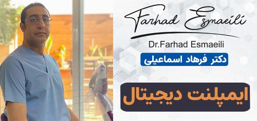 ایمپلنت دیجیتال در اصفهان توسط بهرین متخصص دکتر فرهاد اسماعیلی