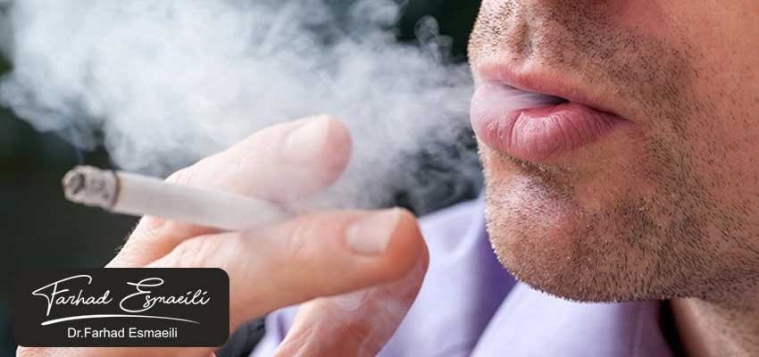 چه مدت بعد از ایمپلنت میتوان سیگار کشید؟