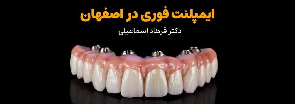 دکتر فرهاد اسماعیلی متخصص ایمپلنت فوری در اصفهان