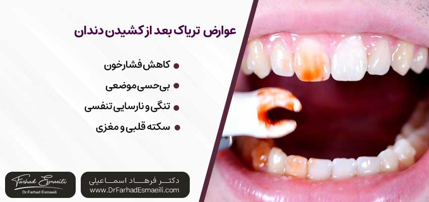کشیدن تریاک بعد از کشیدن دندان