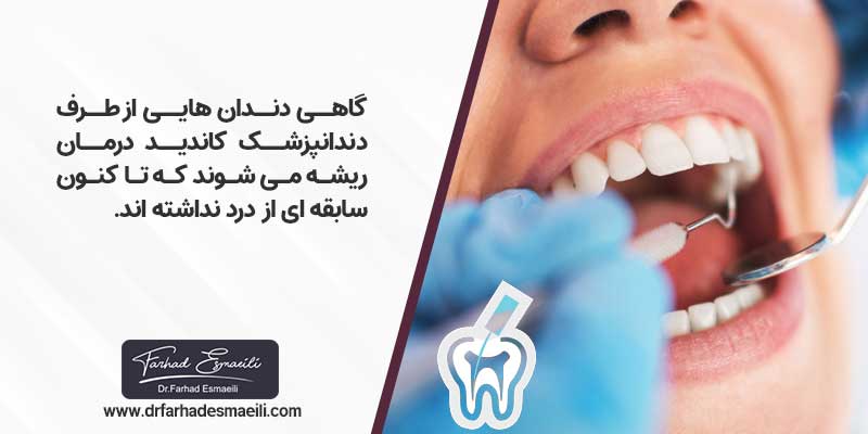 انتخاب دندان برای درمان ریشه