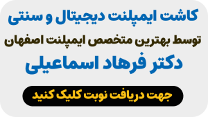 دریافت نوبت ایمپلنت دیجیتال در اصفهان