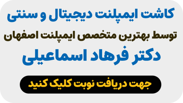 دریافت نوبت ایمپلنت دیجیتال در اصفهان