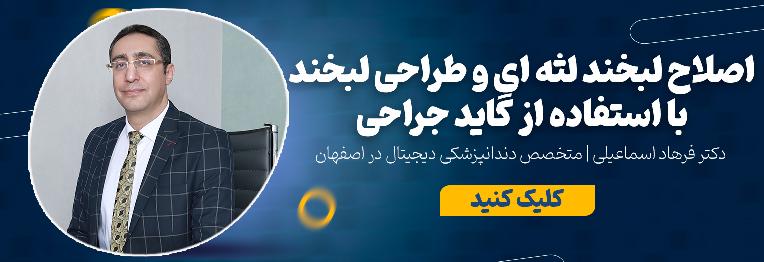 اصلاح لبخند لثه ای با استفاده از دندانپزشکی دیجیتال