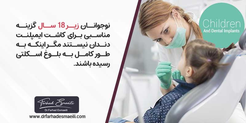 محدوده سنی کاشت ایمپلنت