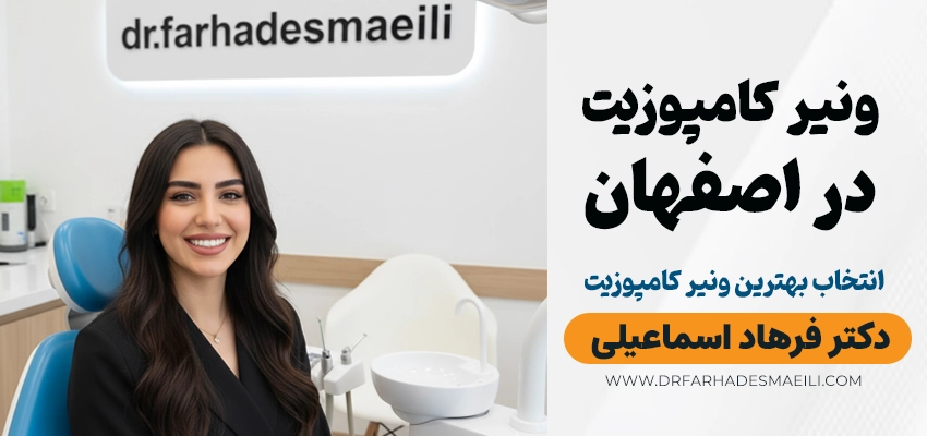 ونیر کامپوزیت در اصفهان در کلینیک دکتر فرهاد اسماعیلی