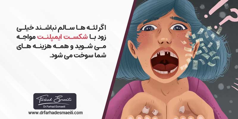 اهمیت سلامت لثه در کاشت ایمپلنت