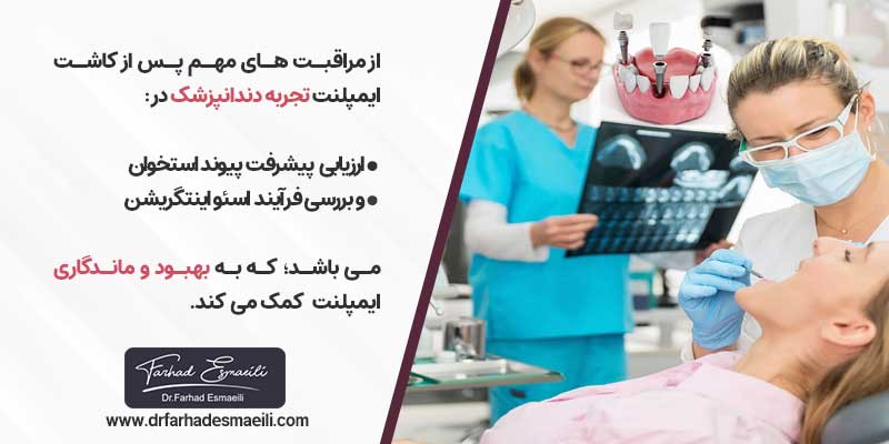 مراقبت های لازم پس از کاشت ایمپلنت