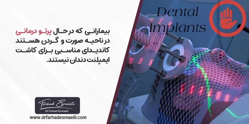 افرادی که در حال پرتو درمانی گردن و صورت هستند گزینه مناسبی برای کاشت ایمپلنت نیستند