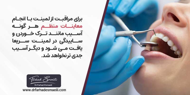 مراقبت از لمینت با انجام معاینات منظم