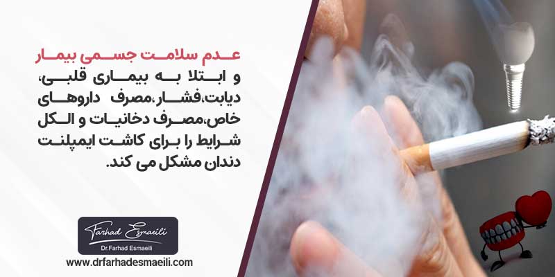 شرایط جسمانی بیمار برای کاشت ایمپلنت