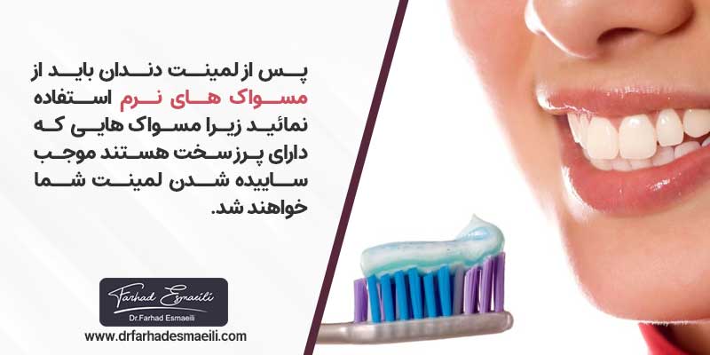 یکی از مراقبت های پس از لمینت دندان استفاده از مسواک نرم است