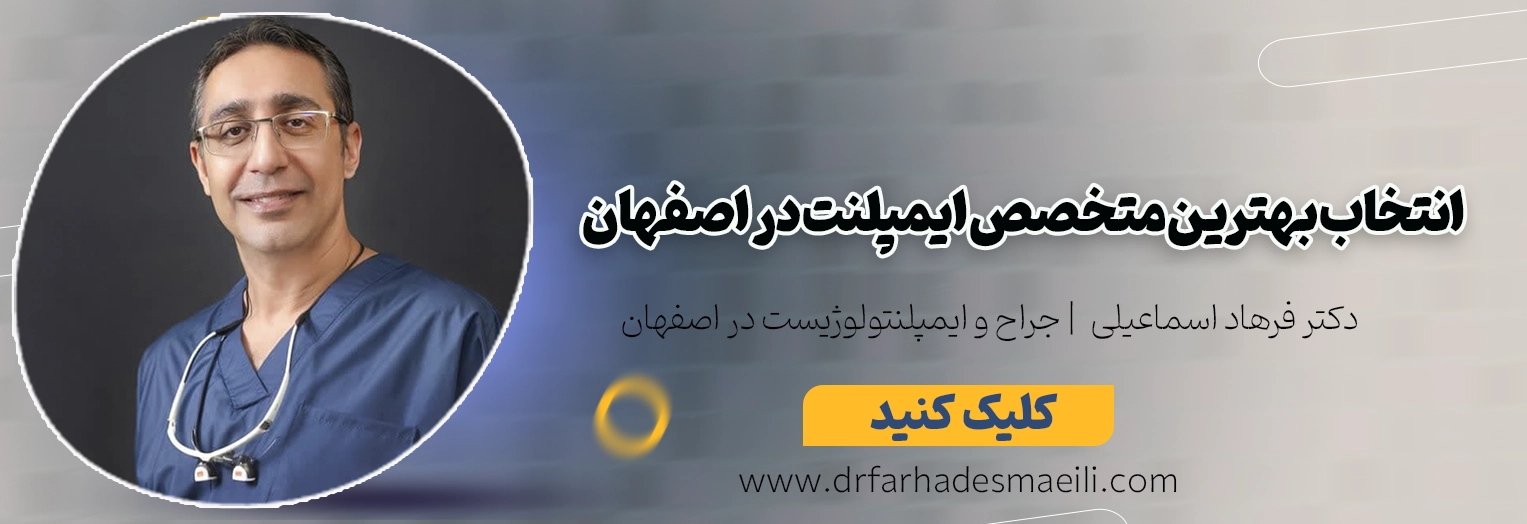 بهترین متخصص ایمپلنت در اصفهان: راهنمای انتخاب و معرفی دکتر فرهاد اسماعیلی