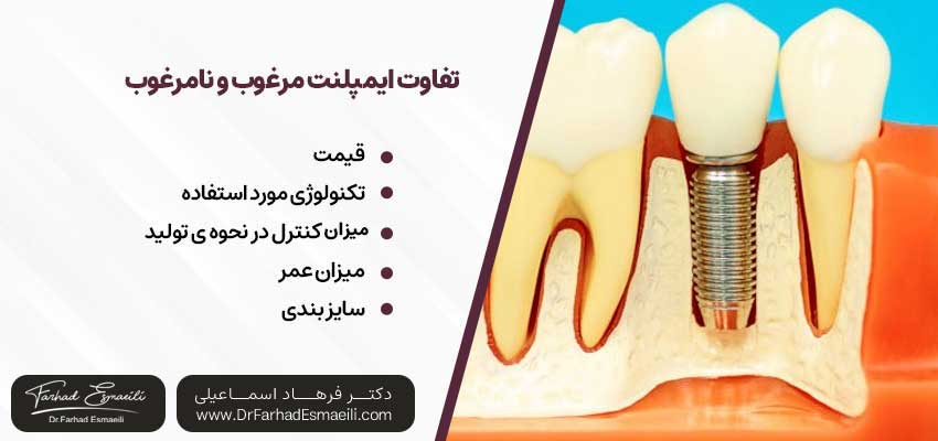 یک ایمپلنت خوب چه تفاوتهایی با ایمپلنت نامرغوب دارد؟