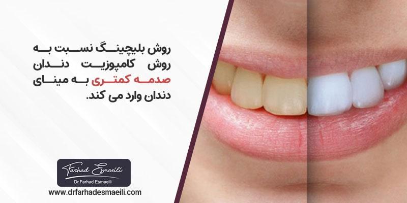 بلیچینگ دندان بهتر است یا کامپوزیت