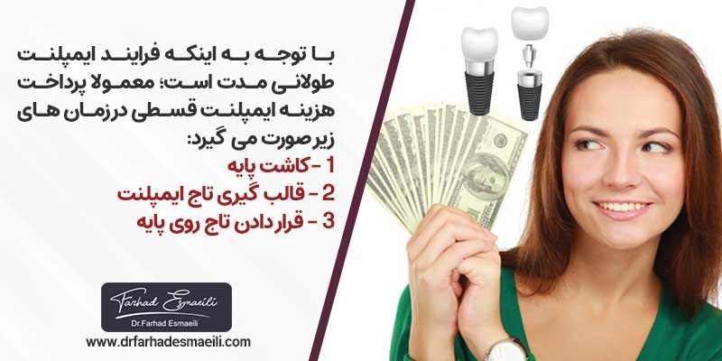  پرداخت قسطی هزینه های ایمپلنت دندان