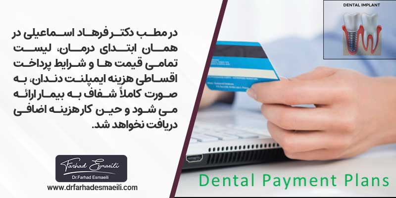 شرایط پرداخت اقساطی هزینه های ایمپلنت دندان