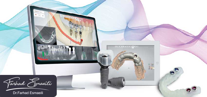 درمان بی دندانی با استفاده از ایمپلنت دیجیتال