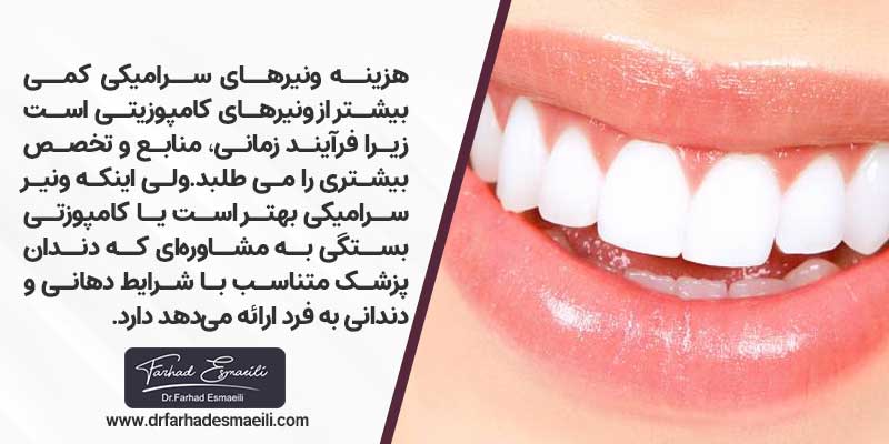 لمینت سرامیکی بهتر است یا کامپوزتی؟
