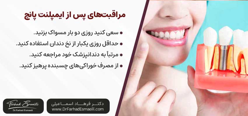 مراقبت های پس از کاشت ایمپلنت پانچ | دکتر فرهاد اسماعیلی متخصص ایمپلنت اصفهان