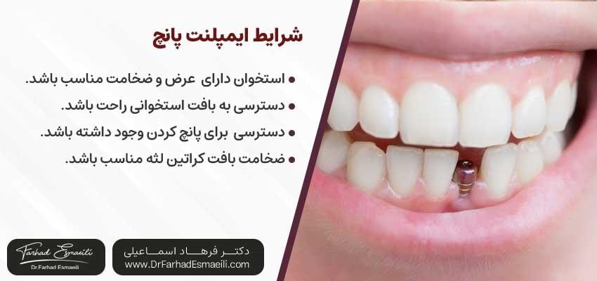 شرایط ایمپلنت پانچ| دکتر فرهاد اسماعیلی متخصص ایمپلنت اصفهان