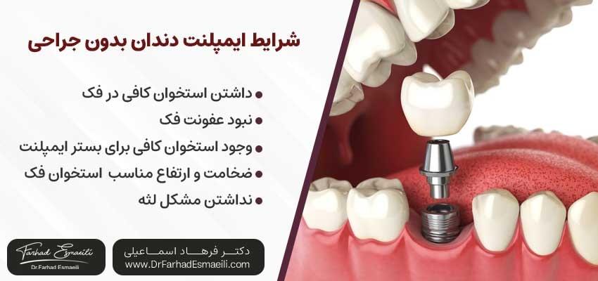 شرایط ایمپلنت دندان بدون جراحی | دکتر فرهاد اسماعیلی متخصص ایمپلنت اصفهان